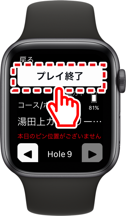 Apple Watch11